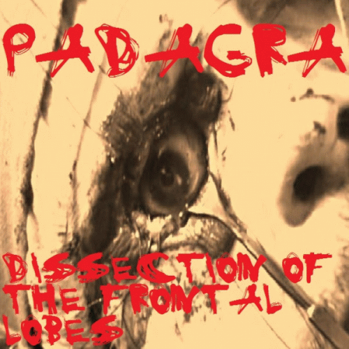 Padagra : Dissection of the Frontal Lobes